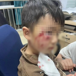河南3岁男童被恶犬咬伤致死事件：舆情分析与社会反思