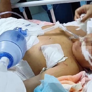 【舆情分析】社区噪音纠纷酿悲剧：一父子遭下楼邻居行凶，1死1伤 ...